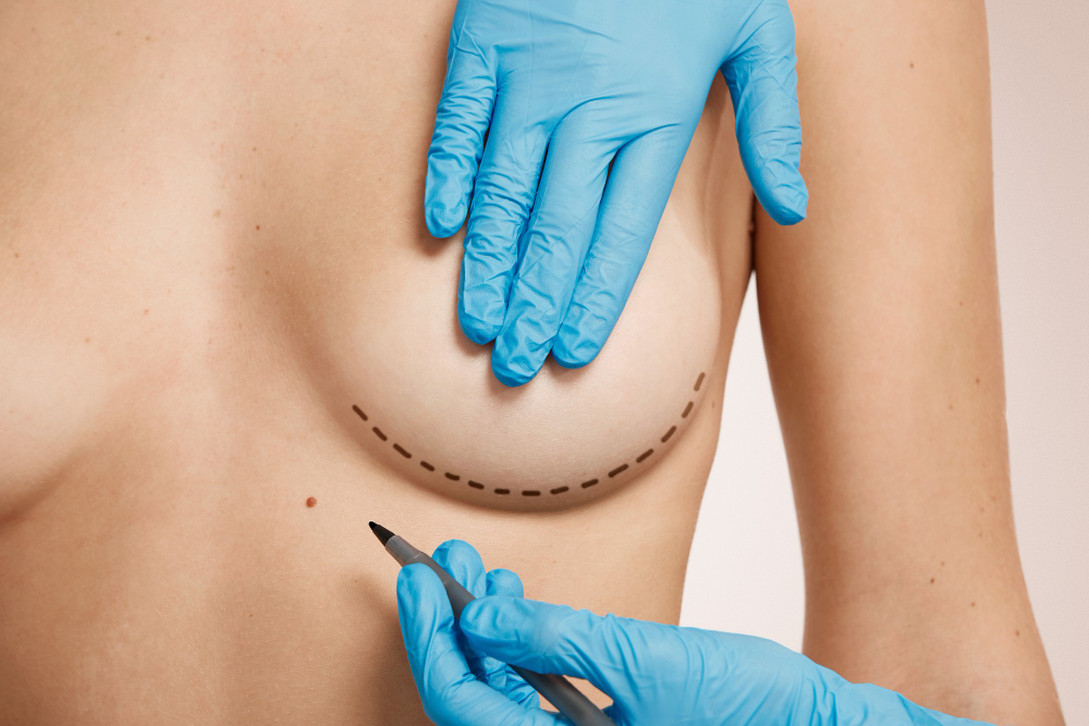 Cirugía Pechos, Mamoplastia (Reducción)