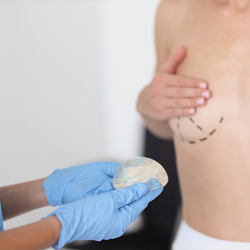 Medicina Estética, Cirugía Pechos